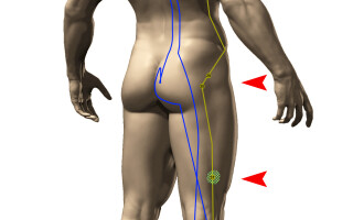 Малая ягодичная мышца (m. gluteus minimus)