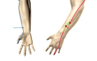 Длинная мышца, отводящая большой палец кисти (m. abductor pollicis longus)