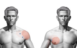 Большая грудная мышца (m. pectoralis major)