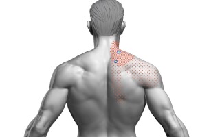 Мышца, поднимающая лопатку (m. levator scapulae)
